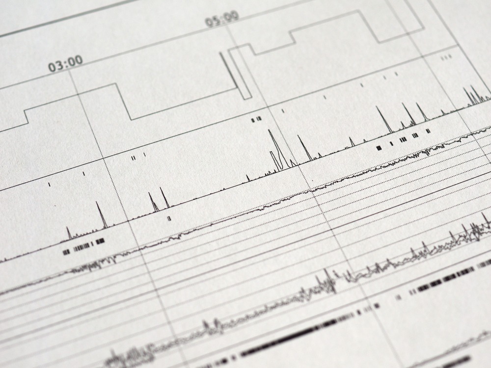 Polysomnography,(psg),Sleep,Study,Multi,Parametric,Test,Diagnostic,Tool