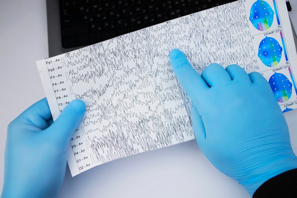 A,Neurologist,Examines,An,Encephalogram,Of,A,Patient’s,Brain.,Schedule